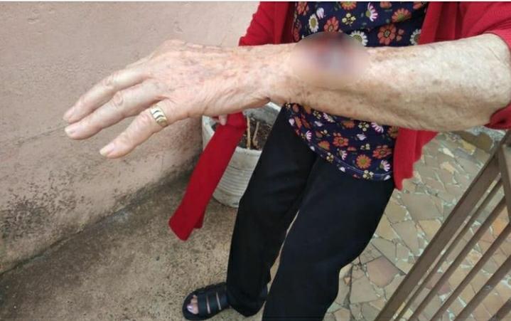 Mão e braço da idosa feridos. A polícia civil foi acionada após uma mulher de 36 anos agredir a avó, em Anápolis. Mulher teria se irritado com a idosa.