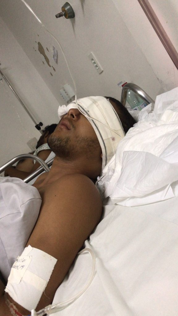 Júlio Cesar Martins de 19 anos, foi baleado com 4 tiros. O jovem perdeu os movimentos das pernas e o olho.
