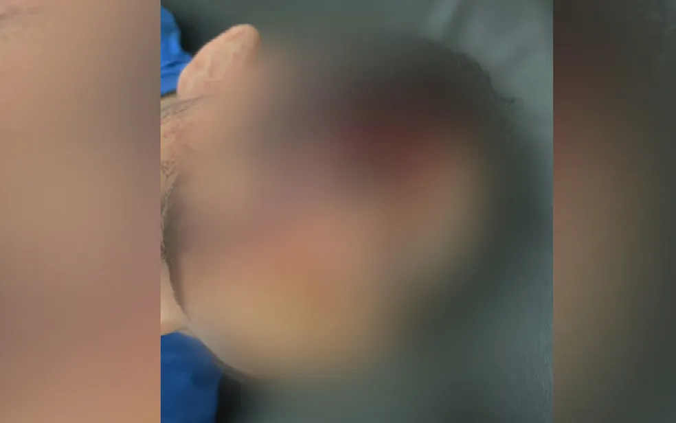 Jovem é agredido por motorista de aplicativo após amiga passar mal, em Anápolis
