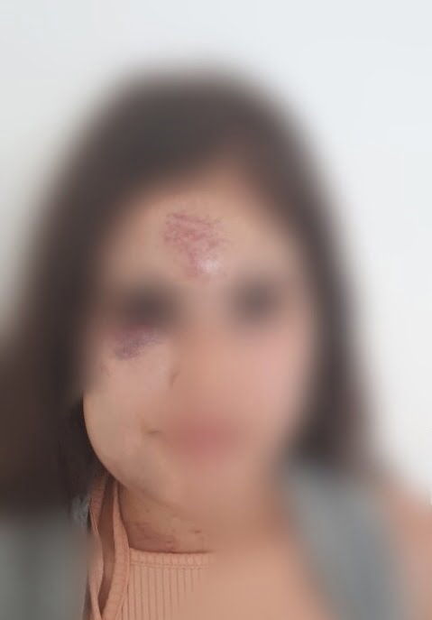 Homem é preso após espancar e fraturar mandíbula de mulher em Planaltina