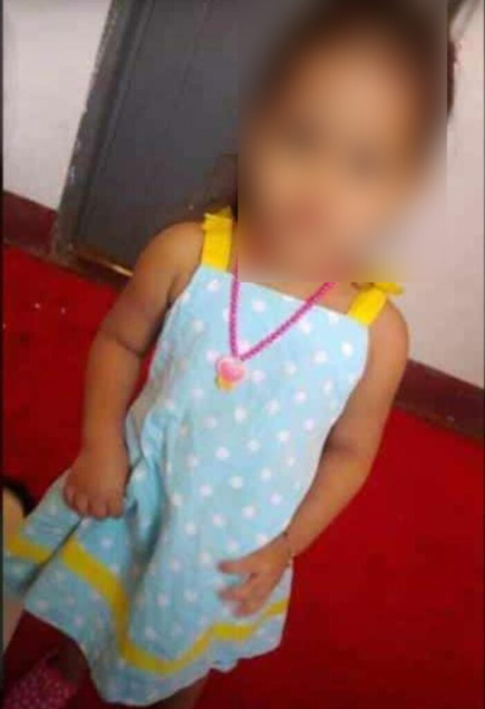 Criança de quatro anos é espancada e queimada por mãe e madrasta é internada na UTI