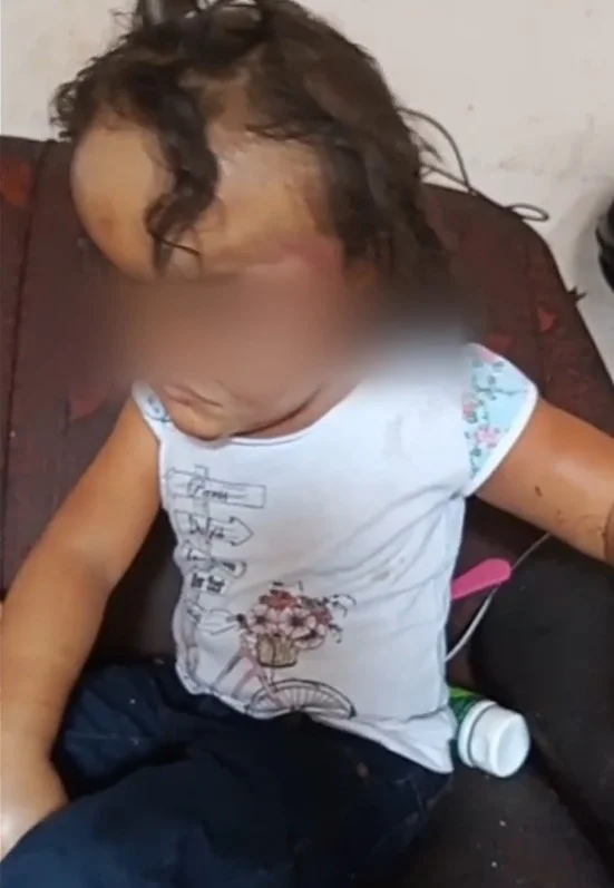 Criança de quatro anos é espancada e queimada por mãe e madrasta é internada na UTI (Foto: divulgação PC)