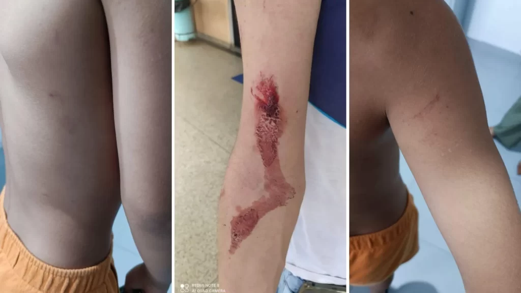 Menino é agredido por pai de colega após briga por confete, em Porangatu