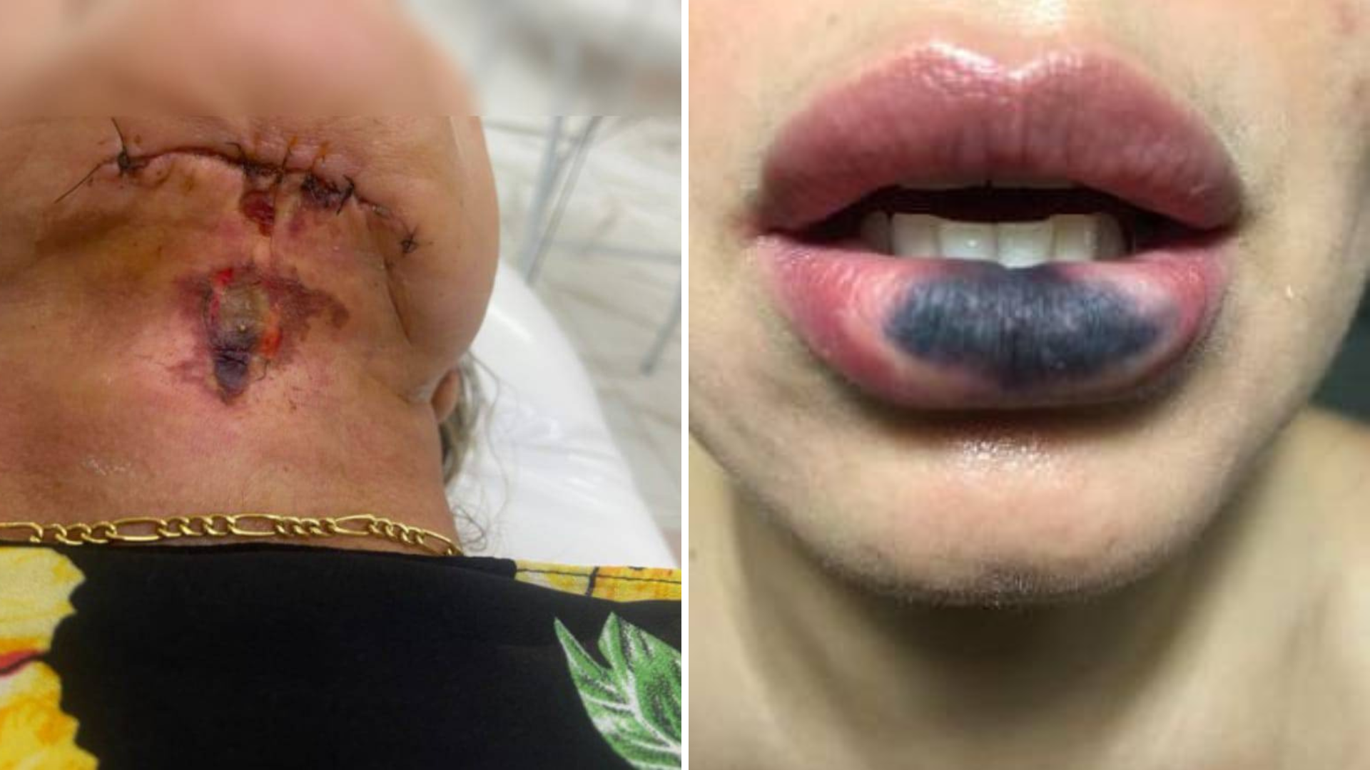 Dentista é presa por suspeita de deformar rosto de pacientes em Goiânia