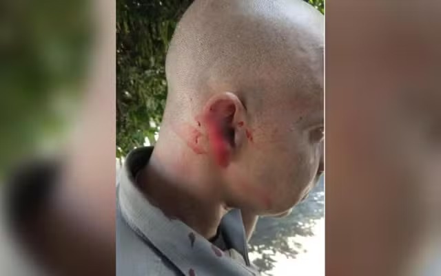 Policial tem parte de orelha arrancada por homem durante abordagem da PM
