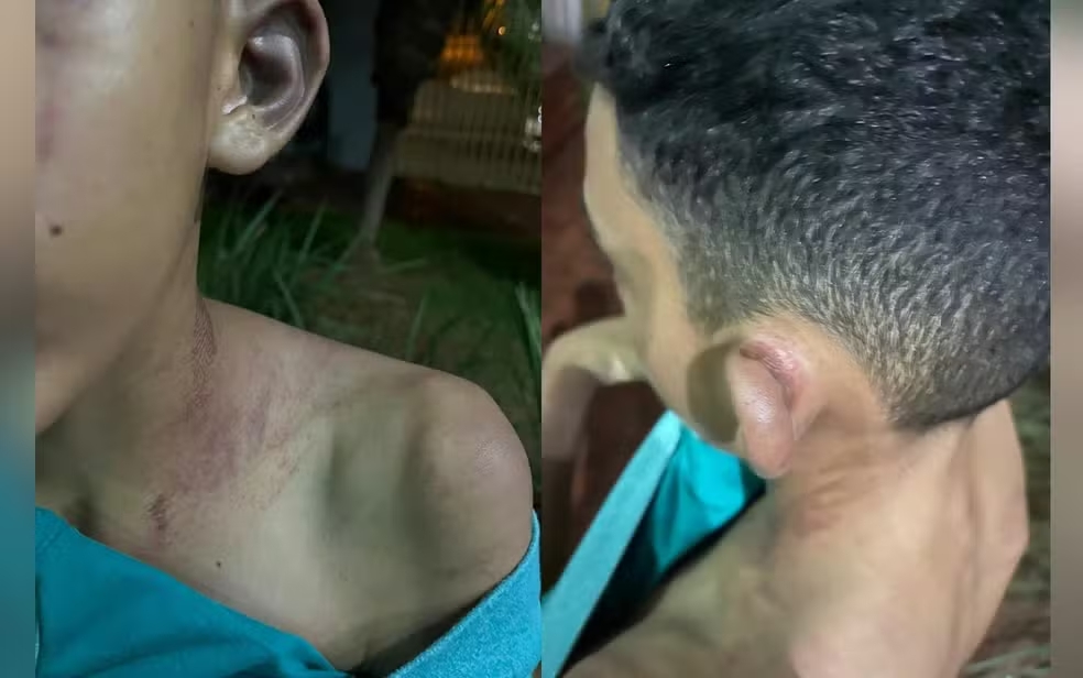 Adolescente é agredido por padrasto por causa de jogos eletrônicos, em Rio Verde