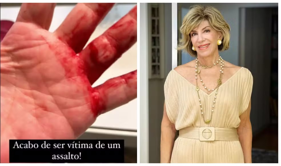 Silvia Poppovic revela que sofreu um assalto violento: “'Me estrangulou, rasgou meu dedo”