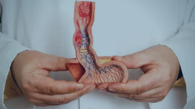 Novo estudo brasileiro inova no tratamento do câncer de pênis (Reprodução/CBU - Centro brasileiro de Urologia)
