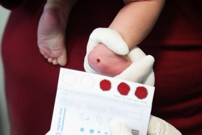 Junho Lilás alerta sobre a importância do teste do pezinho em recém-nascidos: em 2023, as três maternidades da Prefeitura de Goiânia realizaram, juntas, mais de 6,7 mil testes