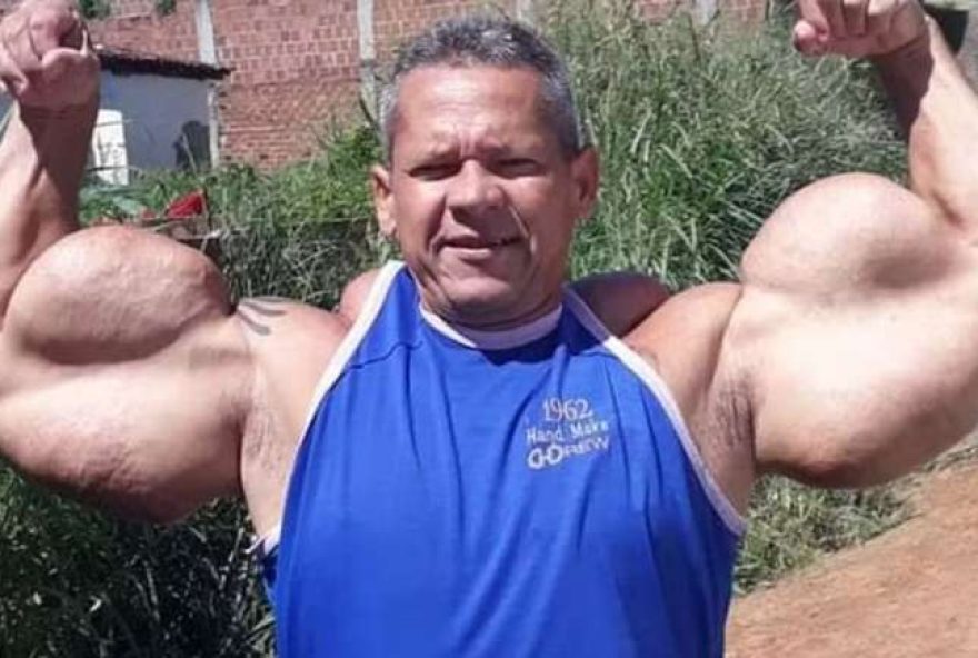 22popeye-brasileiro2C-arlindo-de-souza2C-morre-aos-55-anos3A-licao-sobre-os-perigos-da-busca-pela-estetica22 22popeye-brasileiro2C-arlindo-de-souza2C-morre-aos-55-anos3A-licao-sobre-os-perigos-da-busca-pela-estetica22