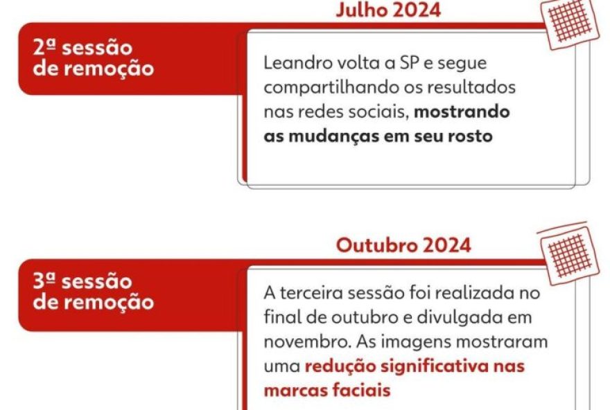 22transformacao-do-mais-tatuado-do-brasil3A-da-conversao-a-remocao-das-tatuagens22