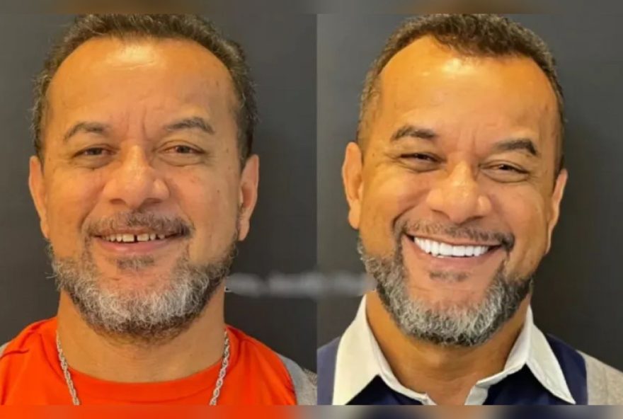 Marido de Luiz Carlos denunciou dentista por negligência. (Foto: Arquivo DE)