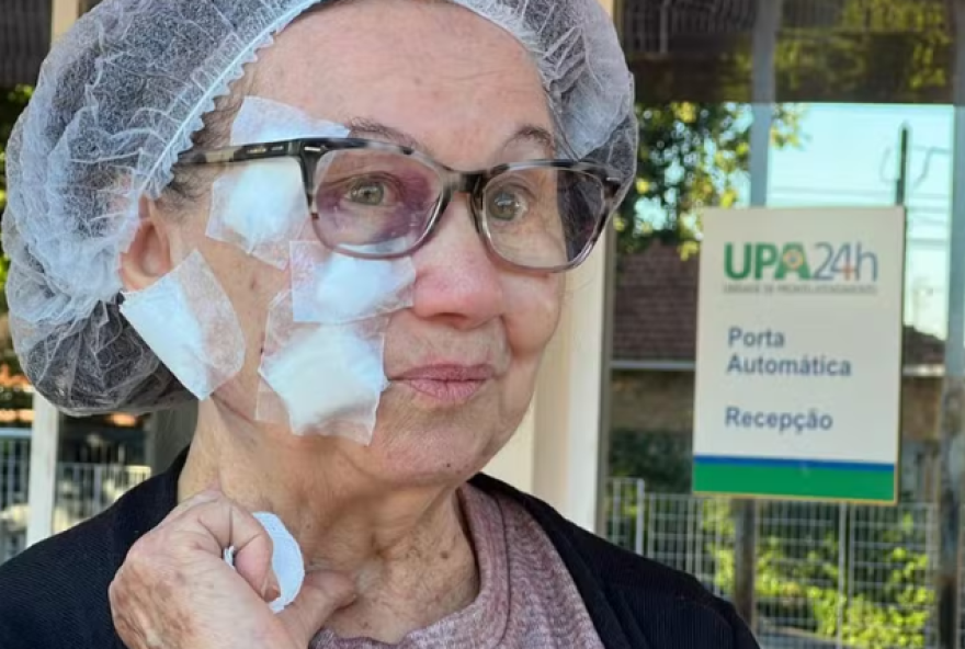 Vítima estava passeando com os cachorros quando foi atacada pelo PitBull. (Foto: Reprodução)