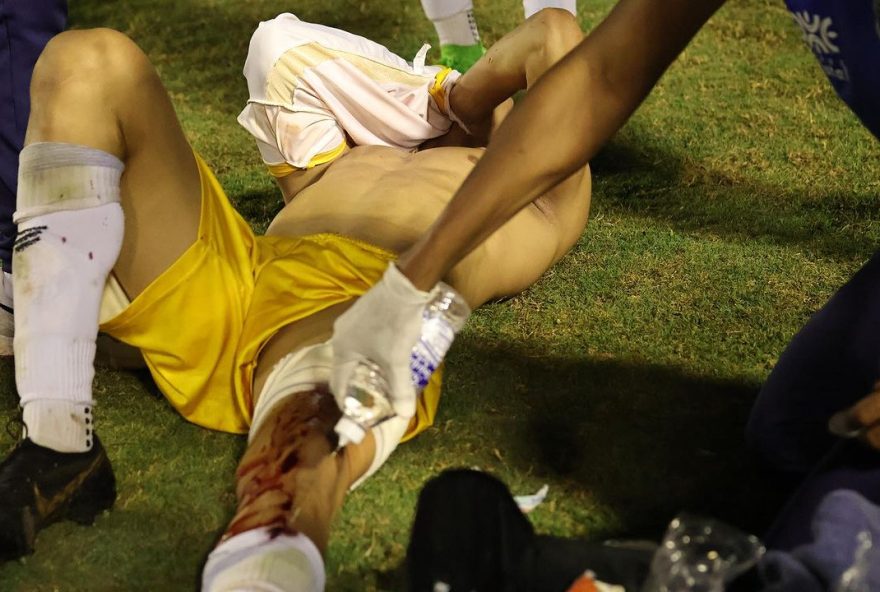 Ramón Souza foi baleado durante uma confusão na linha lateral do gramado, durante a disputa pela 12ª Divisão de Acesso do Campeonato Goiano. (Foto: Grêmio Anápolis/Reprodução)