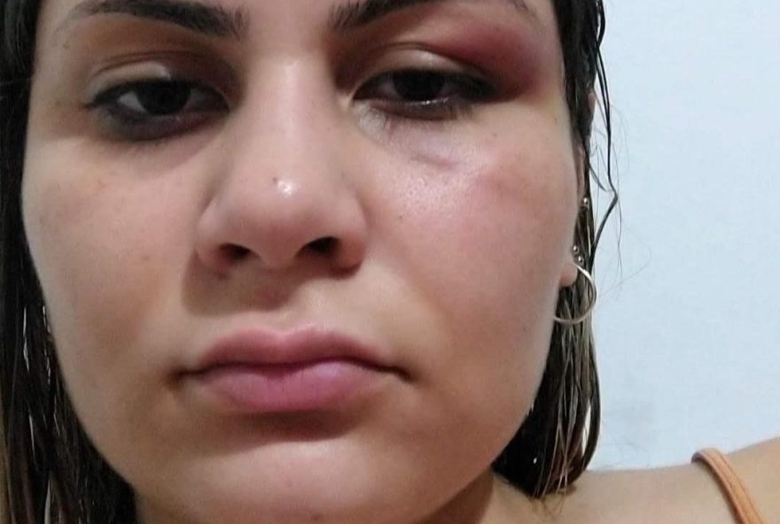 Gabriela Batista Figueiredo de Freitas da Silva mostra agressão.