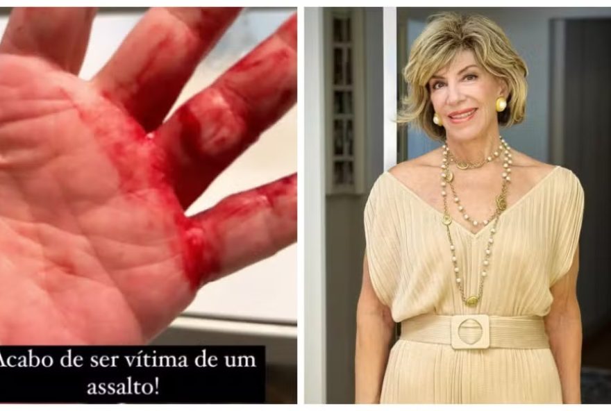 Silvia Poppovic revela que sofreu um assalto violento: “'Me estrangulou, rasgou meu dedo”