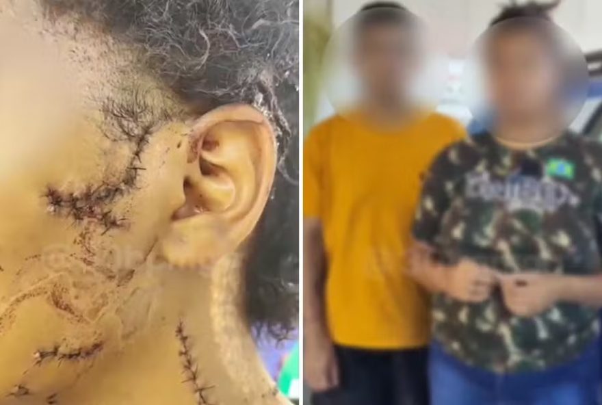 Casal é preso após cortar rosto de adolescente com garrafa de vidro 