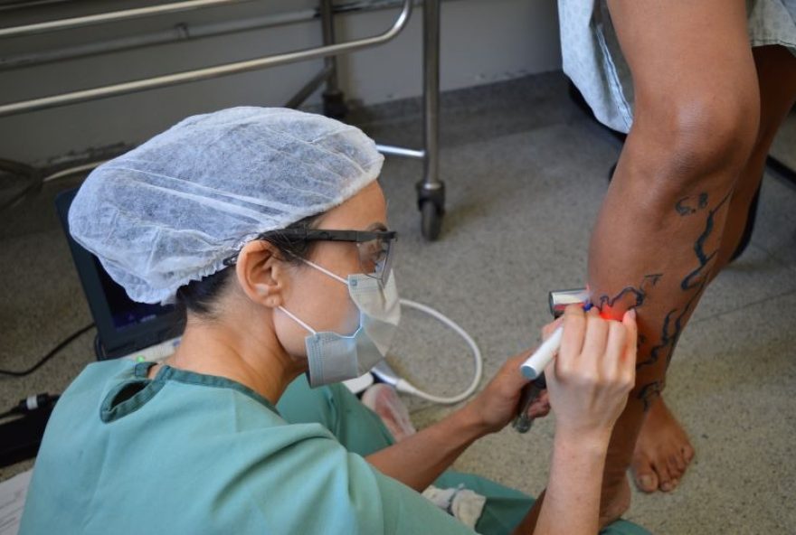 Equipe do Hetrin realiza procedimento de cirurgia vascular por Endolaser durante Mutirão de Cirurgias Eletivas. (Fotos: Hetrin)