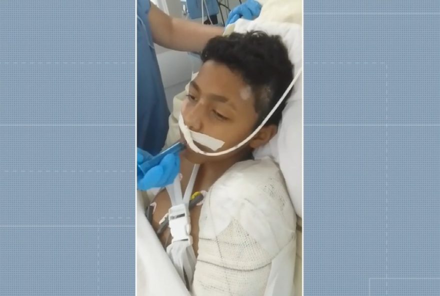 adolescente-atropelado-por-motorista-embriagado-em-campinas-deixa-uti-e-se-recupera3A-familia-busca-justica
