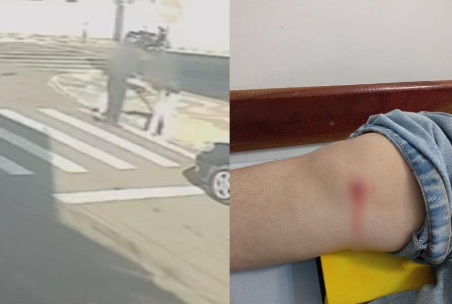 adolescente-de-17-anos-e-atingida-por-bala-perdida-no-joelho3A-caso-em-cornelio-procopio2C-parana