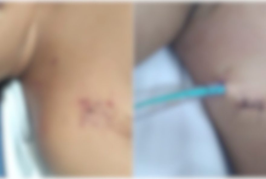 adolescente-gravida-e-agredida-com-chave-de-fenda-em-quixeramobim3A-agressor-desaparece