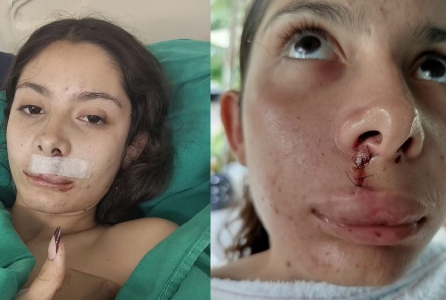 adolescente-morre-e-cantora-e-baleada-antes-de-show-em-igarassu3A-relato-chocante-de-sobrevivencia