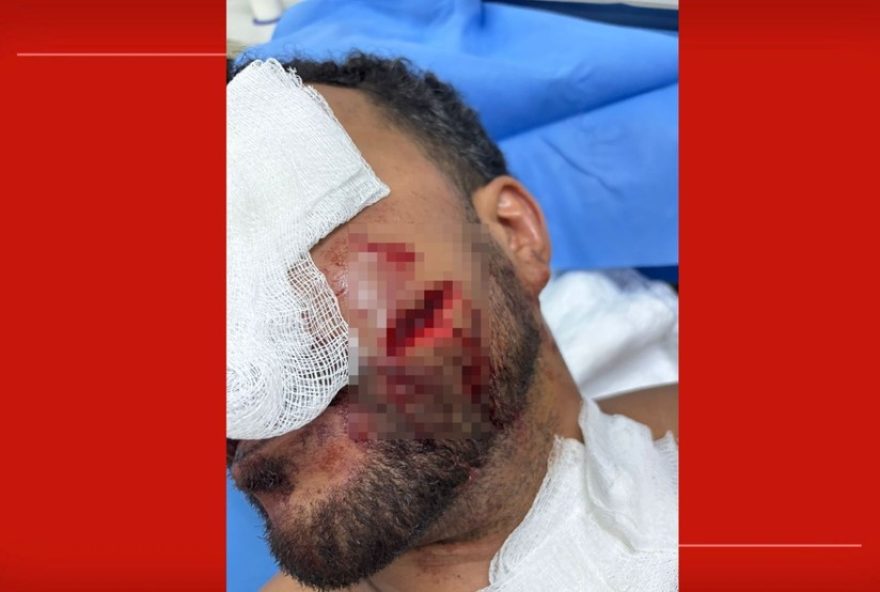 advogado-agride-homem-com-taca-de-vinho-em-hotel-de-brasilia3A-veja-o-video
