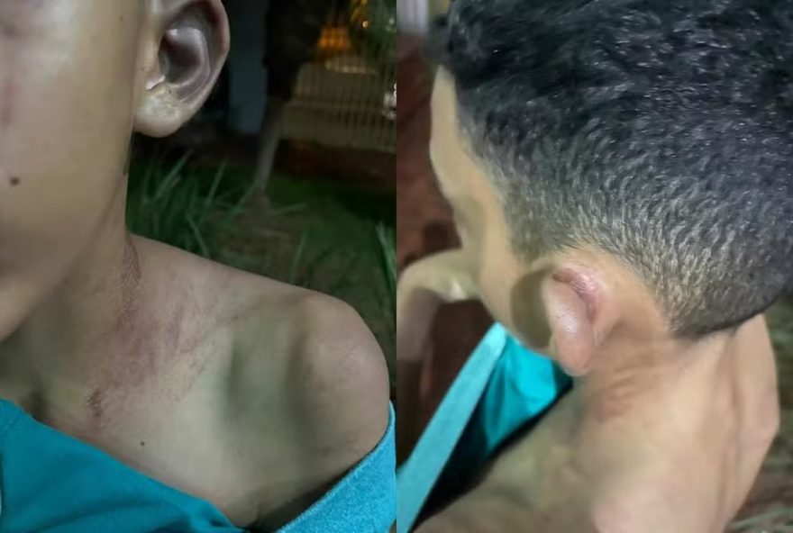 Adolescente é agredido por padrasto por causa de jogos eletrônicos, em Rio Verde