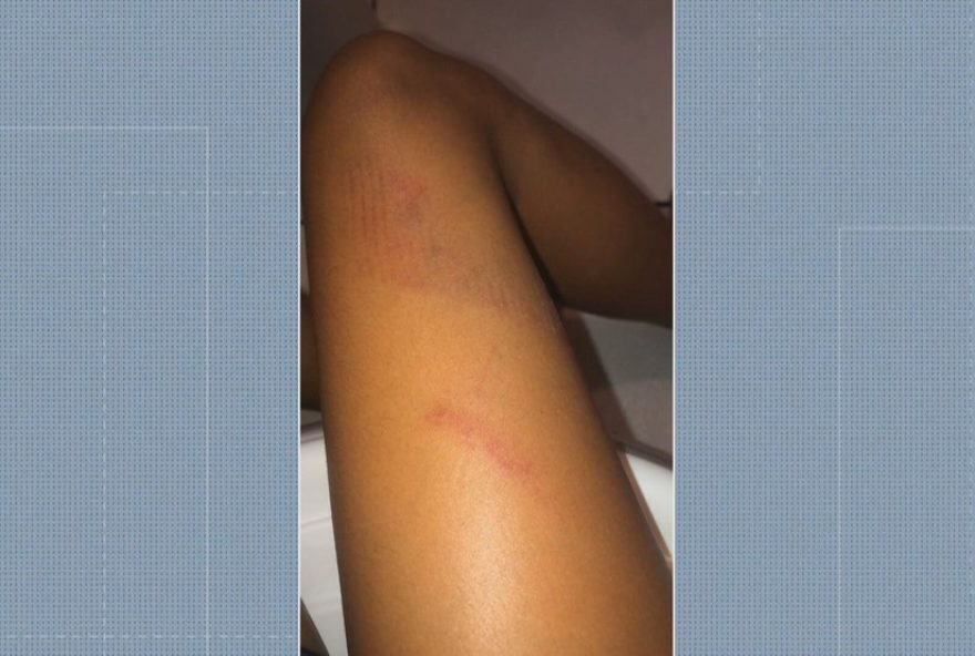 aluna-de-12-anos-e-agredida-por-colega-em-escola-municipal-no-rio aluna-de-12-anos-e-agredida-por-colega-em-escola-municipal-no-rio