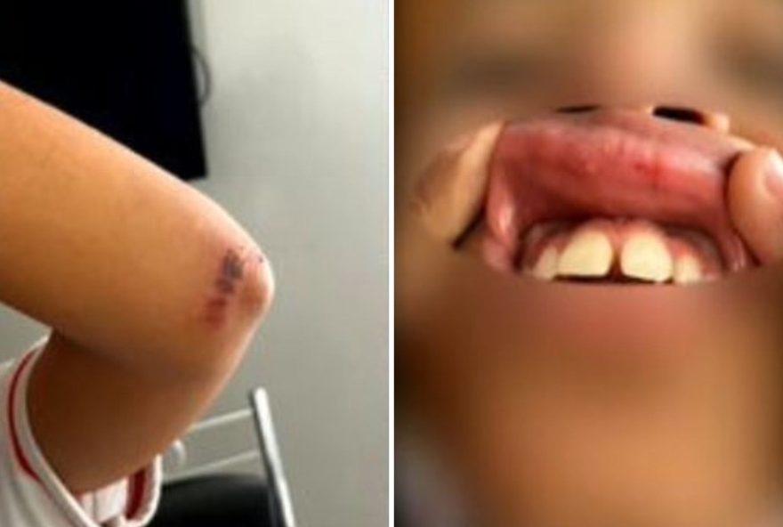 aluna-e-agredida-com-socos-e-tem-dente-quebrado-por-colegas-em-escola-particular-de-goiania3A-escola-toma-medidas-drasticas