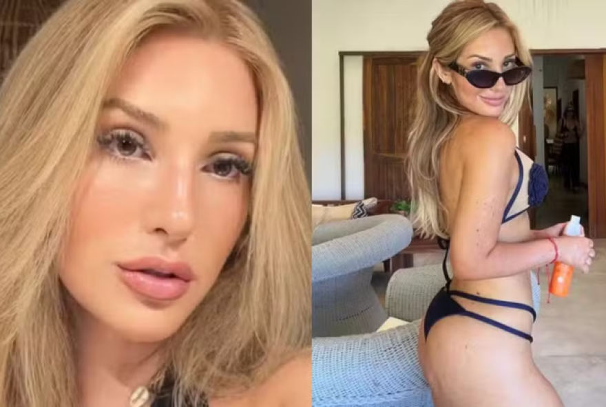 amanda-meirelles-fala-sobre-cirurgia-para-tratar-lipedema-em-entrevista-exclusiva3A-22mudou-minha-vida22 amanda-meirelles-fala-sobre-cirurgia-para-tratar-lipedema-em-entrevista-exclusiva3A-22mudou-minha-vida22