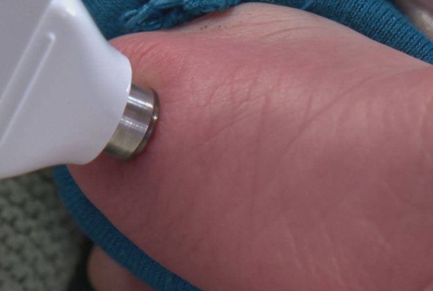 aparelho-ufmg-identifica-idade-gestacional-de-bebes-recem-nascidos aparelho-ufmg-identifica-idade-gestacional-de-bebes-recem-nascidos