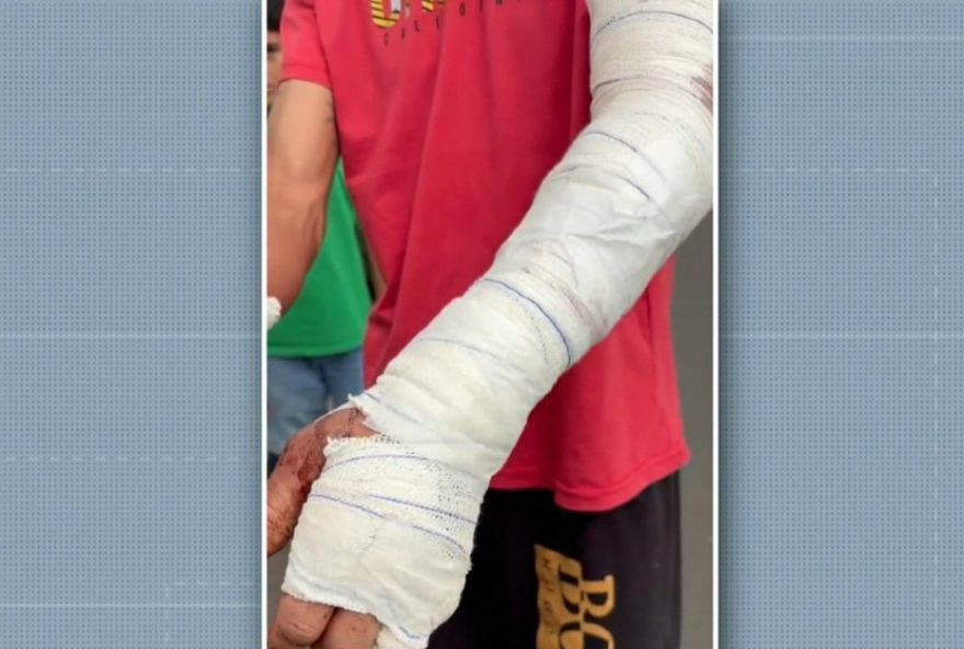 ataque-de-pitbull-em-piracicaba3A-pedreiro-ferido-relata-intervencao-divina