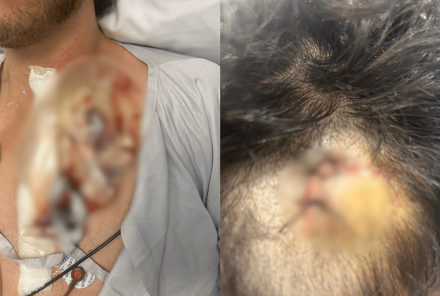 ataque-violento-em-sao-paulo-levanta-preocupacoes-sobre-seguranca-na-rua-da-consolacao3A-homofobia-em-investigacao ataque-violento-em-sao-paulo-levanta-preocupacoes-sobre-seguranca-na-rua-da-consolacao3A-homofobia-em-investigacao