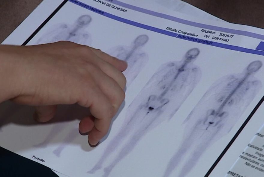 aumento-de-352C425-em-procedimentos-para-fibromialgia-em-sao-paulo-1 aumento-de-352C425-em-procedimentos-para-fibromialgia-em-sao-paulo-1