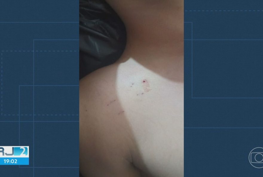 aumento-de-acidentes-com-animais-venenosos-preocupa-no-rio-de-janeiro-em-2025