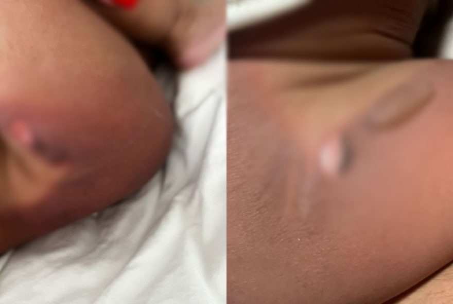 bebe-de-11-meses-sofre-queimaduras-em-creche-de-jau3A-servidora-pede-demissao0A bebe-de-11-meses-sofre-queimaduras-em-creche-de-jau3A-servidora-pede-demissao0A