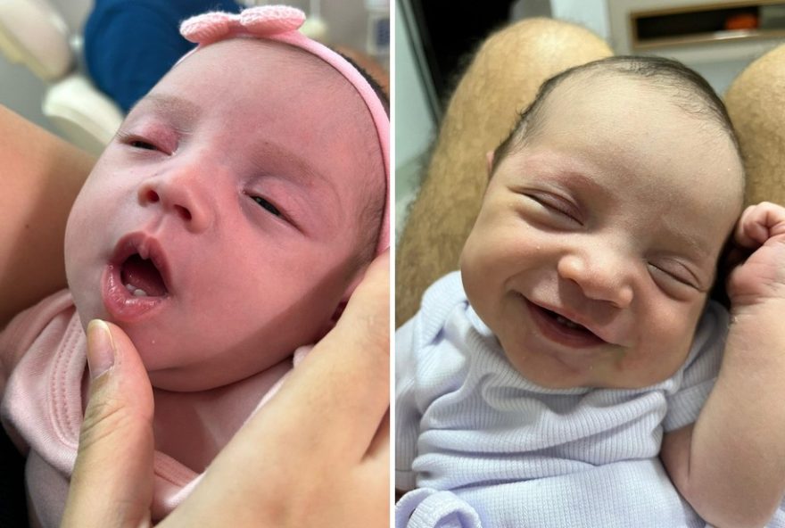 bebe-nasce-com-dentes-em-goias3A-22vi-assim-que-ela-chorou222C-cirurgia-necessaria