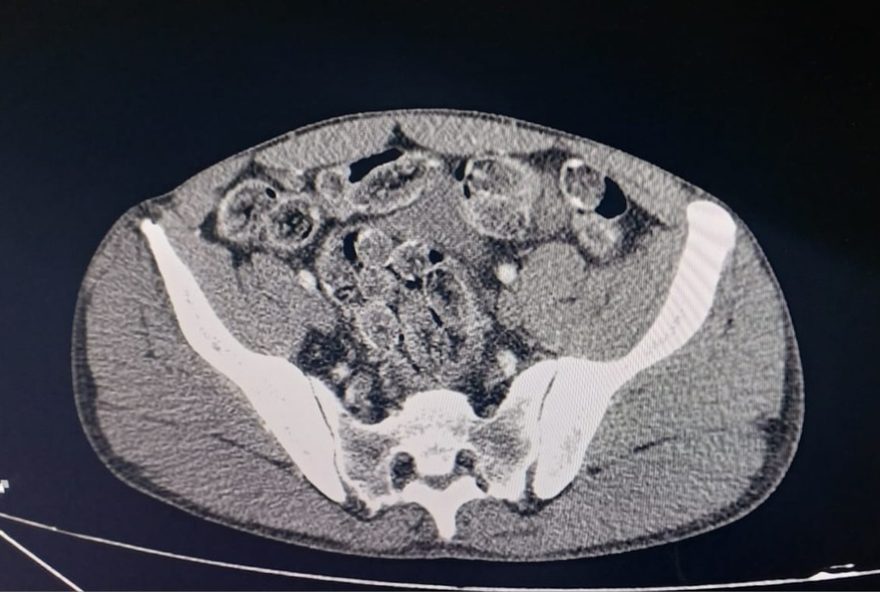 bolivianos-presos-com-capsulas-de-cocaina-na-rodovia-castello-branco-em-itu3A-detalhes-da-abordagem-e-procedimentos-medicos bolivianos-presos-com-capsulas-de-cocaina-na-rodovia-castello-branco-em-itu3A-detalhes-da-abordagem-e-procedimentos-medicos