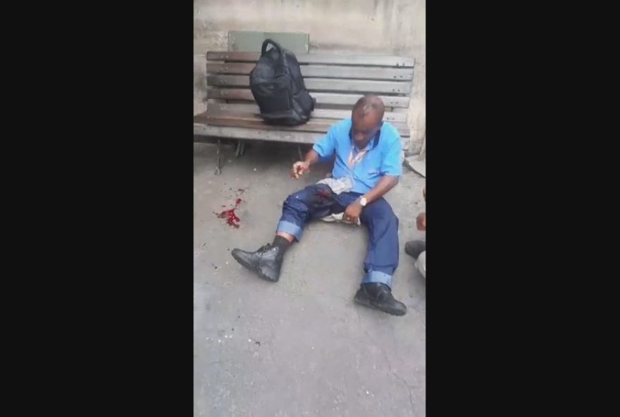 bomba-caseira-deixa-8-feridos-na-ilha-do-governador bomba-caseira-deixa-8-feridos-na-ilha-do-governador