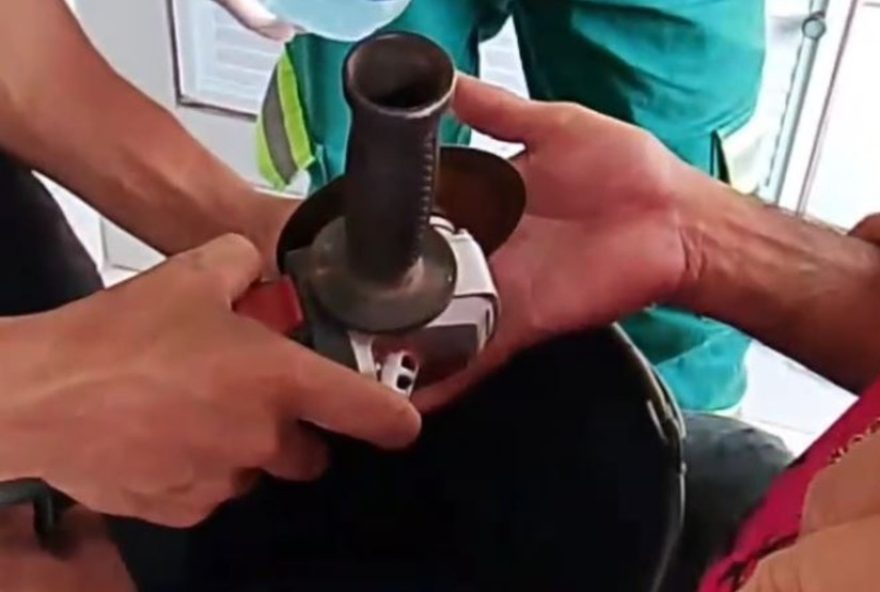 bombeiros-retiram-8-aneis-apertados-dos-dedos-de-homem-em-poranga2C-ceara bombeiros-retiram-8-aneis-apertados-dos-dedos-de-homem-em-poranga2C-ceara