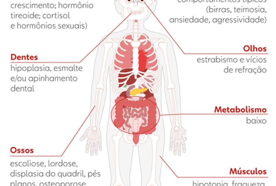 bullying-em-escola-de-fortaleza3A-familia-denuncia-caso-chocante bullying-em-escola-de-fortaleza3A-familia-denuncia-caso-chocante