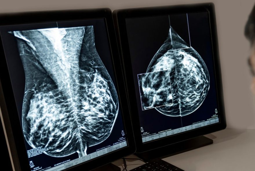 campanha-outubro-rosa3A-rio-de-janeiro-tem-alta-taxa-de-mortalidade-por-cancer-de-mama.-investimento-em-prevencao-e-essencial