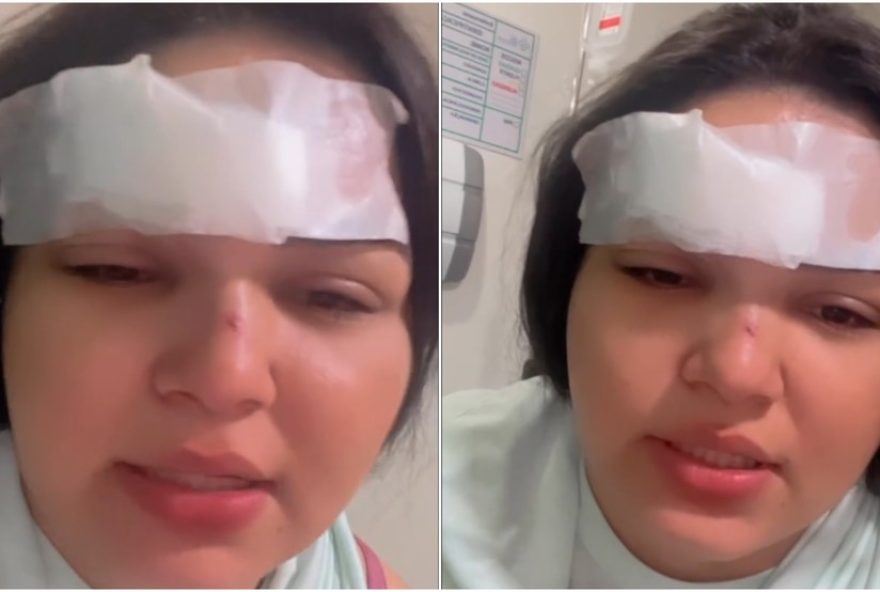 cantora-tem-testa-cortada-em-briga-por-ciumes3A-impacto-da-violencia-interpessoal-no-ceara