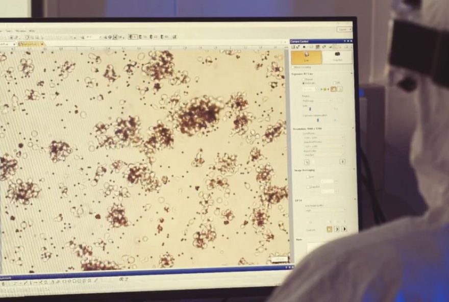 car-t3A-terapia-contra-cancer-pode-ter-registro-na-anvisa-em-20262C-diz-pesquisador