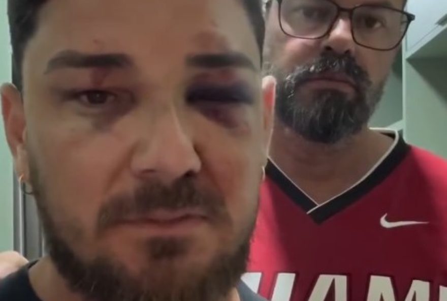 casal-gay-e-agredido-em-porto-de-galinhas-e-relata-motivacao-homofobica casal-gay-e-agredido-em-porto-de-galinhas-e-relata-motivacao-homofobica