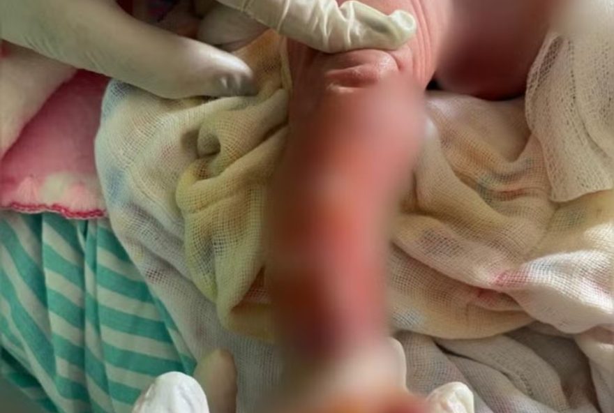 caso-aurora3A-bebe-internada-apos-banho-passa-por-exames-em-mg