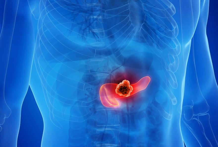 cientistas-conseguem-eliminar-cancer-de-pancreas-em-pesquisas-com-animais cientistas-conseguem-eliminar-cancer-de-pancreas-em-pesquisas-com-animais