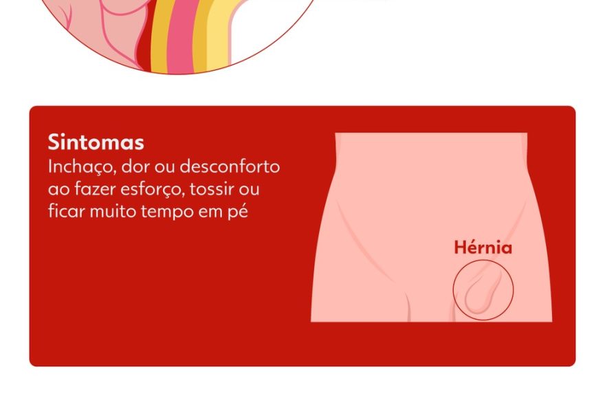 cirurgia-de-bolsonaro3A-3-pontos-sobre-8o-procedimento-desde-facada cirurgia-de-bolsonaro3A-3-pontos-sobre-8o-procedimento-desde-facada