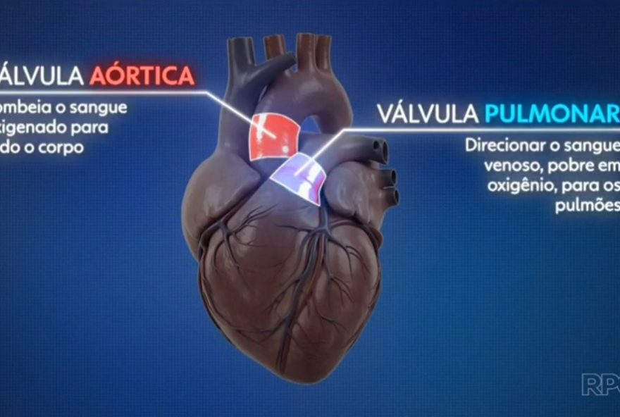 cirurgia-de-ross3A-procedimento-pioneiro-reduz-riscos-cardiacos-no-brasil cirurgia-de-ross3A-procedimento-pioneiro-reduz-riscos-cardiacos-no-brasil